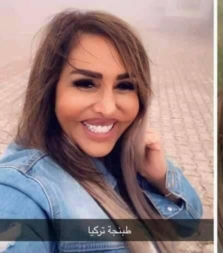 مها المصري عن منتقدي عملية التجميل : آخر همي