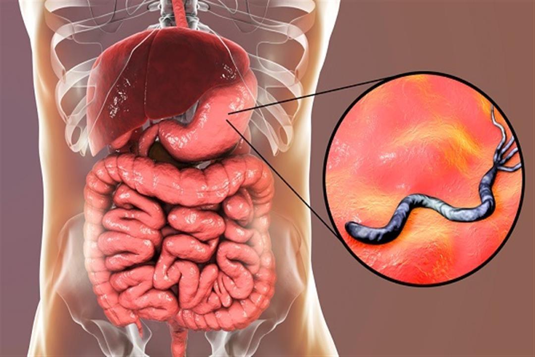 أعراض جرثومة المعدة الظاهرة وعلامات الخطر.. احذرها